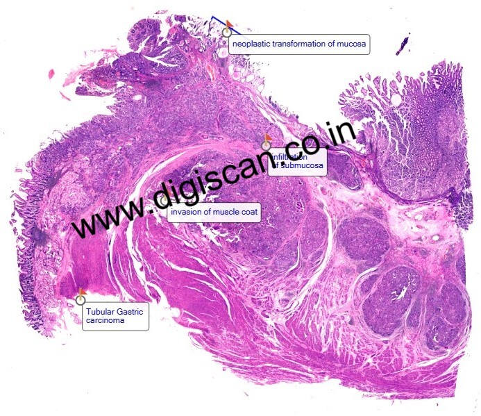 MBBS General Pathology Digital Slides Set (Microscopic Pathology)